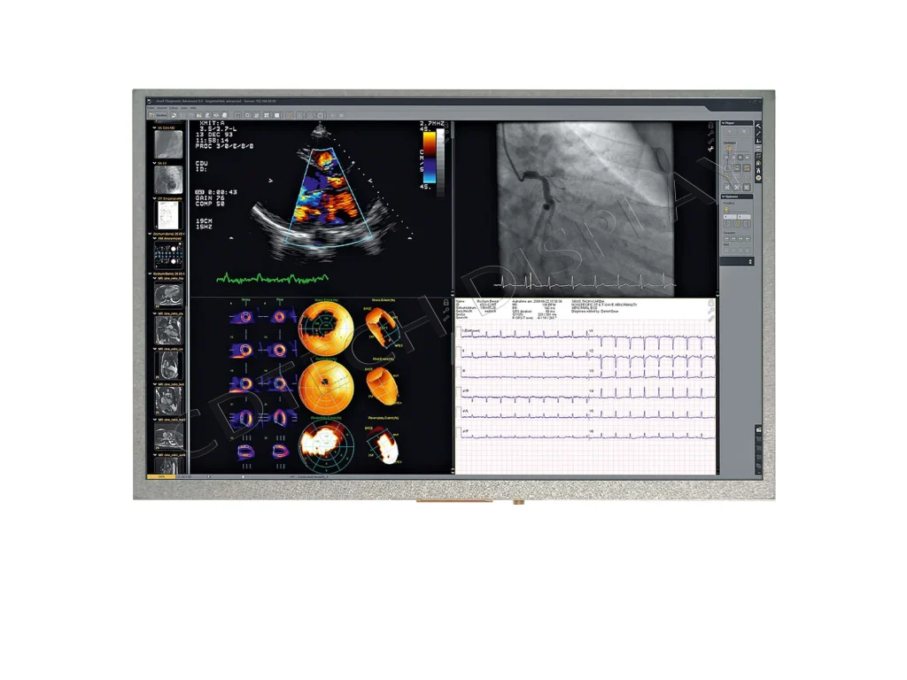10.1 Medical Display-2