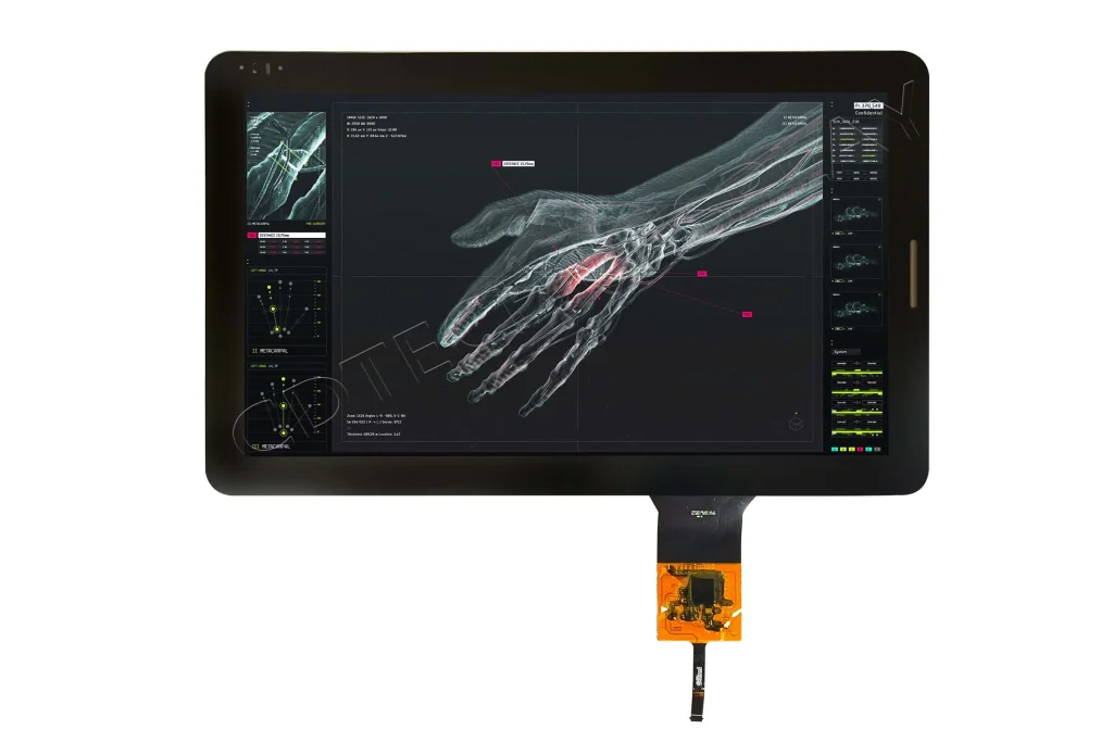 12.8″ IPS LVDS Medical Display-3