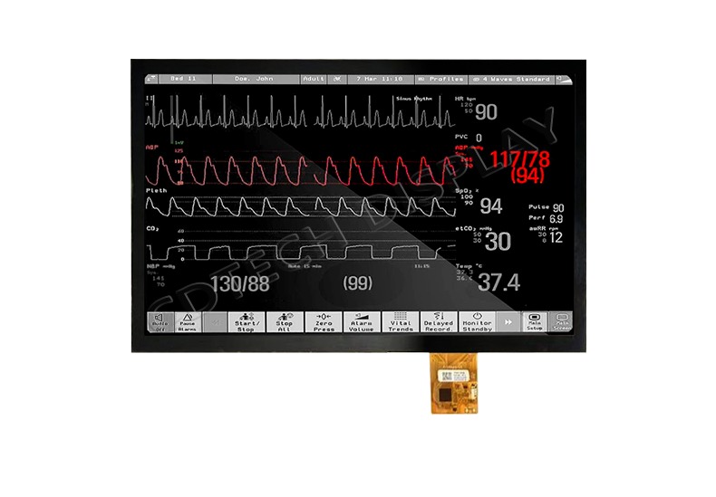 15.6 High-Resolution TFT Medical Touch